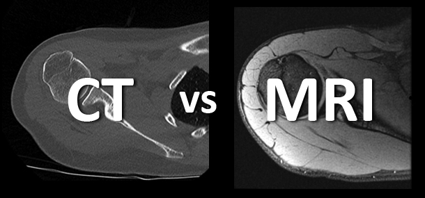 What’s the difference between an MRI and CT? - Cincinnati Children's  Blog