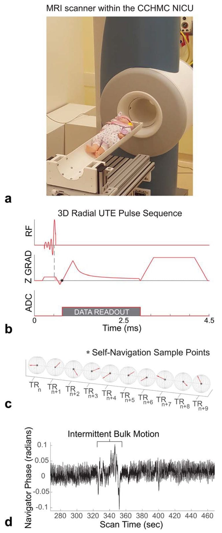 Using 3-D Ultrashort Echo Time And A Small Footprint MRI System ...