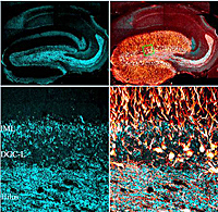 Research Shows Neuron Disruptions Can Trigger Epileptic Seizures ...