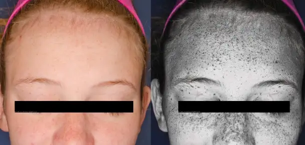 A Shade of Pale is Always Better for Your Skin Than a Tanning Bed