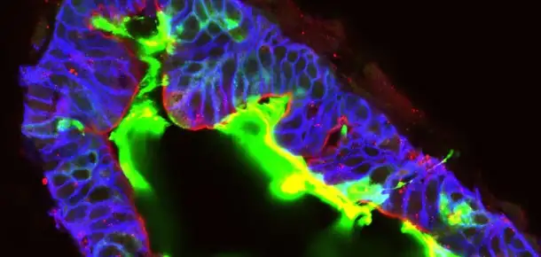 The Universe Within: From stem cells to real tissue