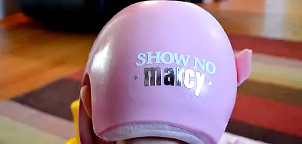 Baby Girl Wears a Helmet to Treat Plagiocephaly