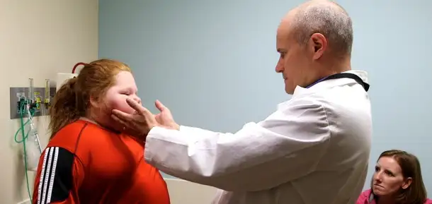 The Immediate Impact of the Sleeve Gastrectomy Procedure