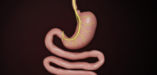 Illustrations Show Surgical Steps for Bariatric Surgery