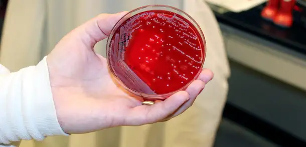 Microbiology Lab: The Germ Detectives