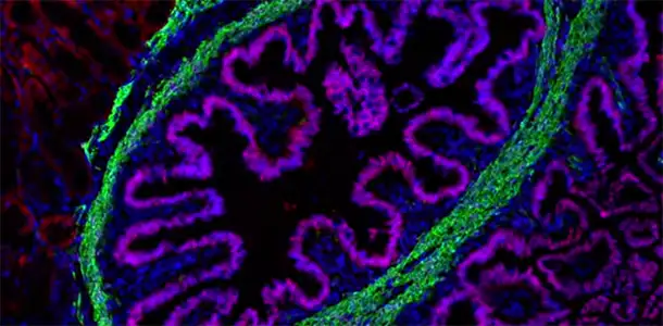 Overcoming Nature’s Complexity to Help Patients with Intestinal Disease