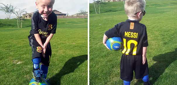 Life After Airway Reconstruction Starts with Soccer Practice