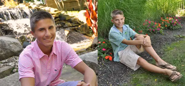 Chiari Malformation: Before and After Decompression Surgery