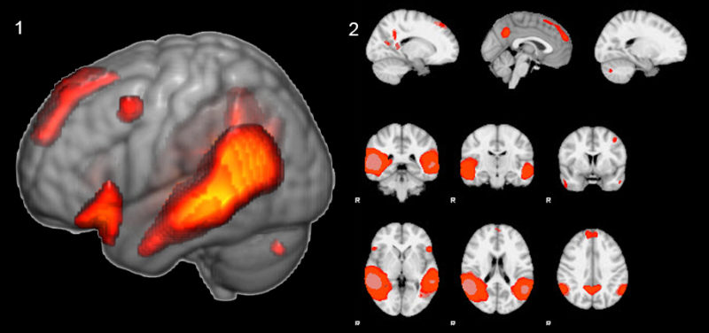 fmri-brain-images