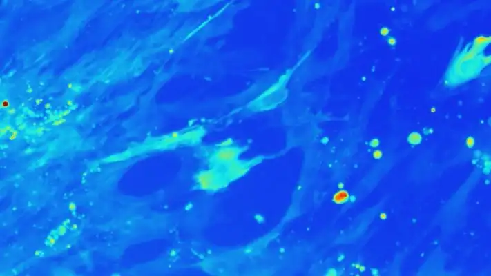 Why I’m Hopeful: Promising Research For Kids with Intestinal Disorders