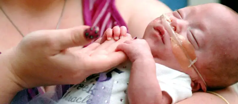 Questions to Ask Your Doctor About Prematurity