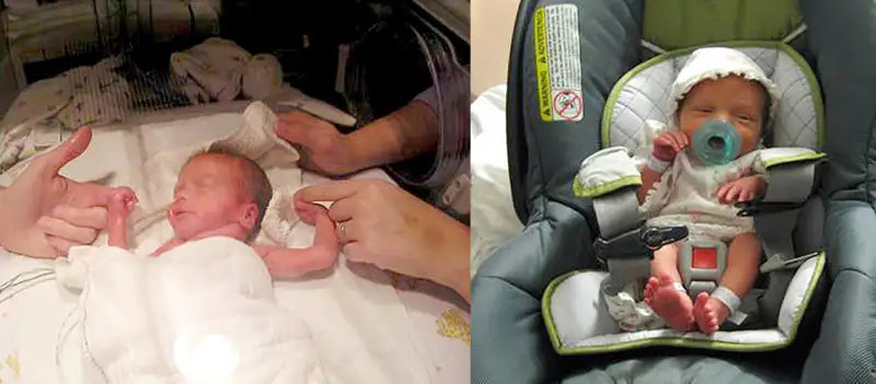 5 Tips for Parents of a Premature Baby