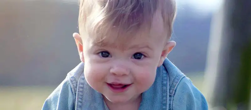 Thoughts Before, During and After Mia’s Cleft Lip Surgical Repair