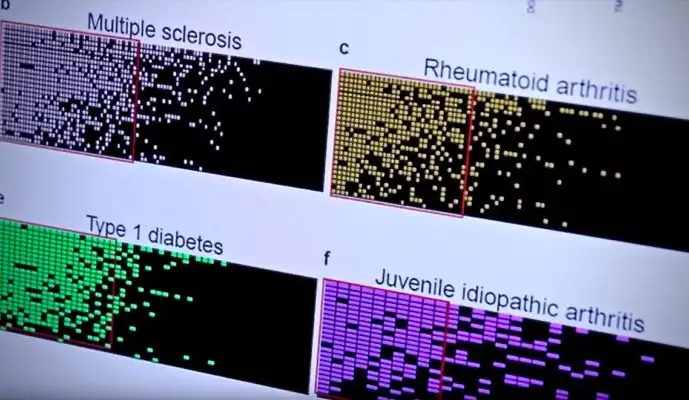 Epstein-Barr Virus Linked to 7 Well-Known Diseases: New Research Q&A