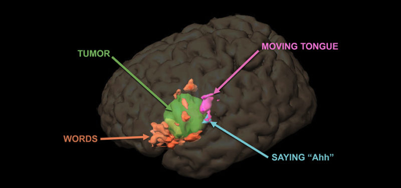 Using fMRI to Locate Regions in the Brain that Control Specific Functions