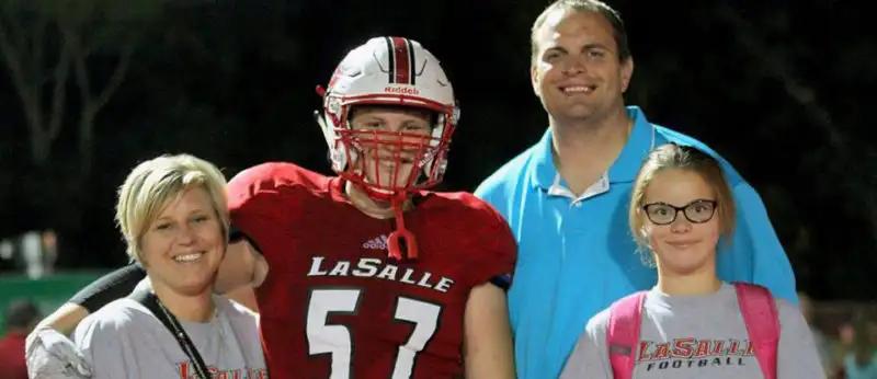 Melkersson-Rosenthal Syndrome: 5 Things To Know