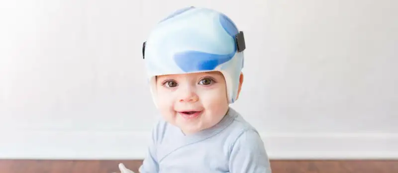 Traveling for our Son’s Endoscopic Craniosynostosis Surgery: What We Learned