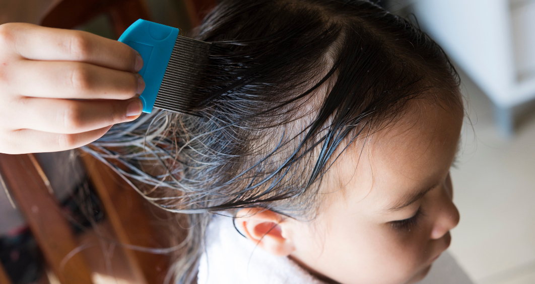 Lice 101: What to Look for and How to Treat Them