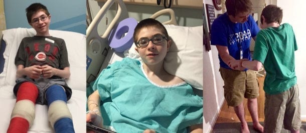 Teen with Cerebral Palsy Now Walks Unassisted Following Surgery