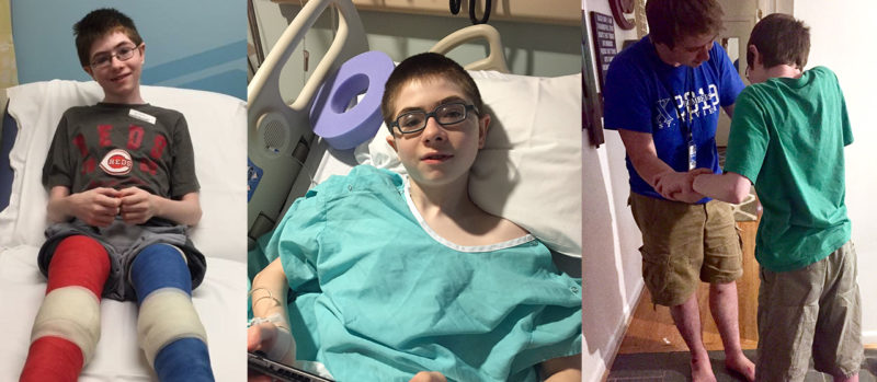 Teen with Cerebral Palsy Now Walks Unassisted Following Minimally Invasive Procedure