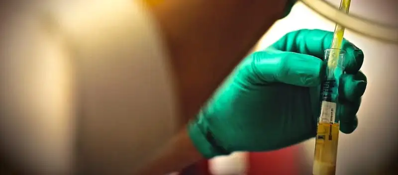 Fighting To Stop Ebola