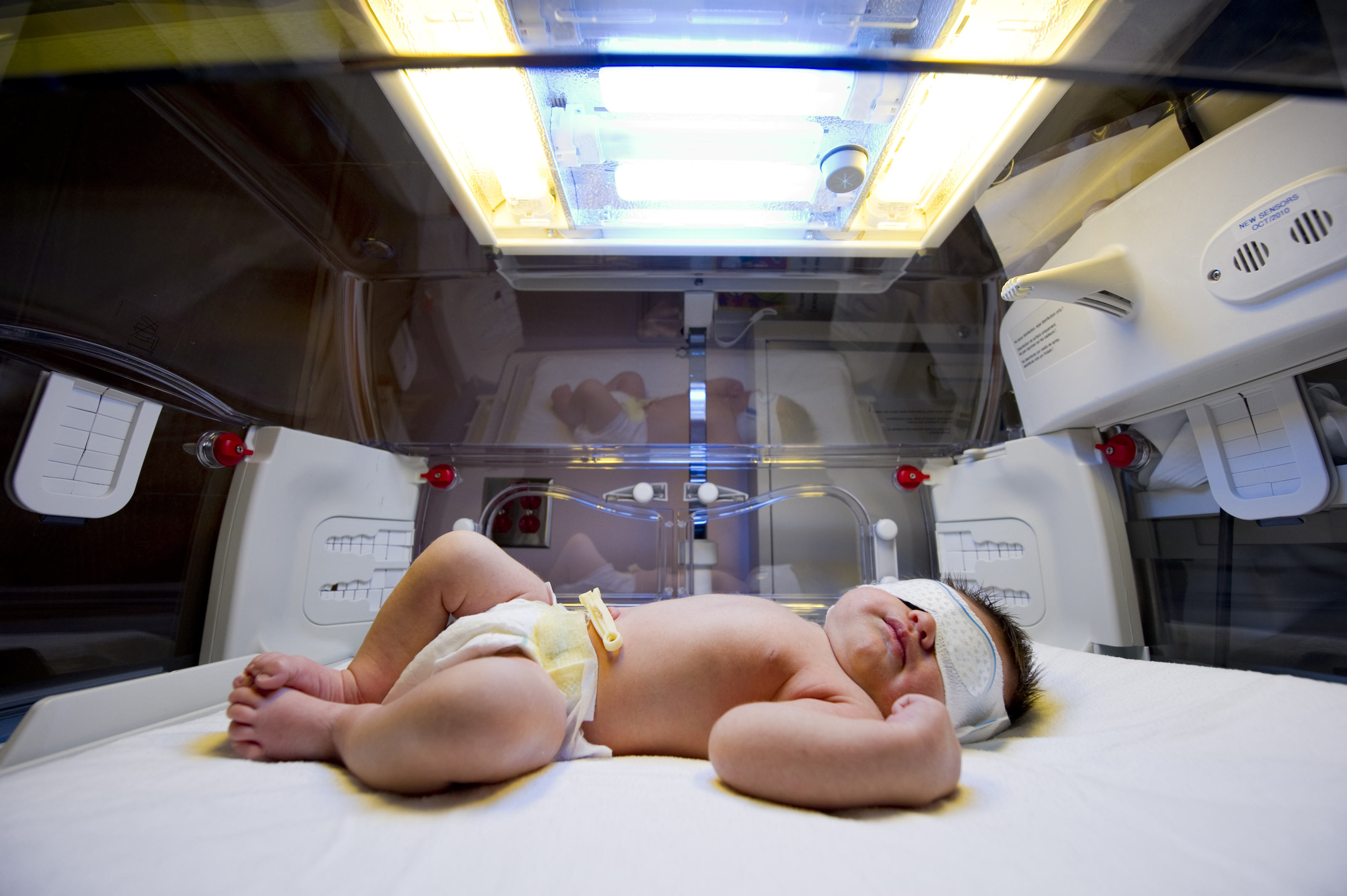 Infant Jaundice: 5 Things Expecting Parents Should Know