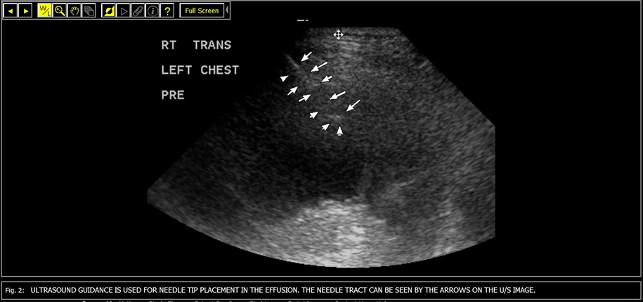 What Can an Ultrasound Exam Be Used For?