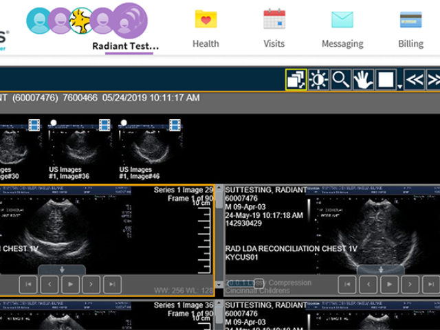 New Features in MyChart Relating to Radiology - Cincinnati Children's Blog