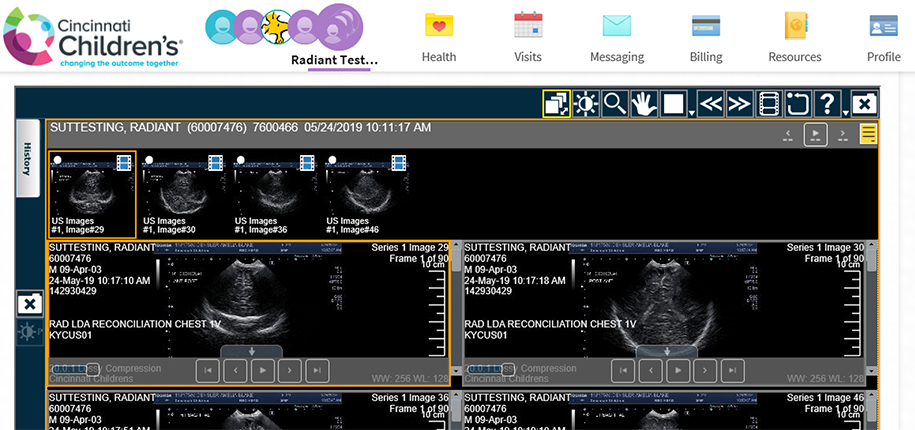 New Features in MyChart Relating to Radiology