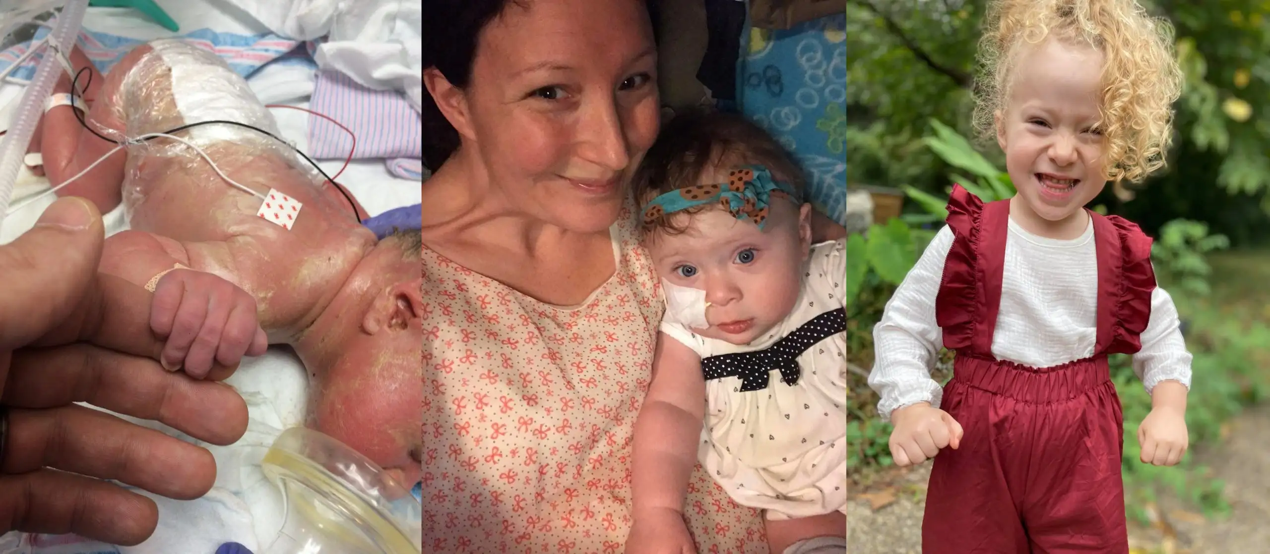 My Daughter’s Spina Bifida Care Journey