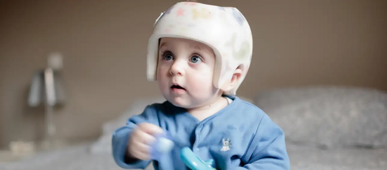 Infant Series: Positional Plagiocephaly and Torticollis