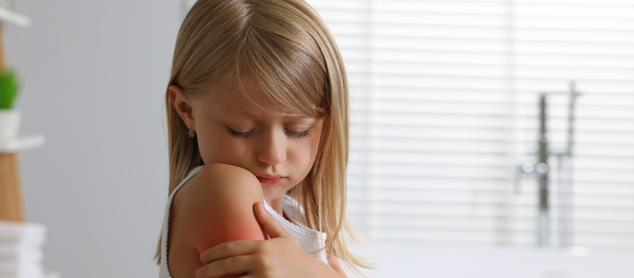 Eczema in Kids: What Parents Should Know