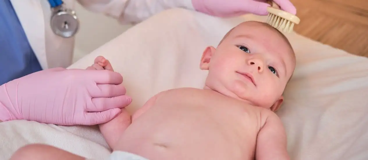 Cradle Cap in Babies: Causes, Treatment and When to Call the Pediatrician